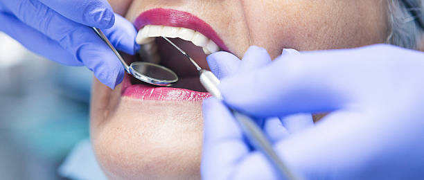 Best Dentist for Tooth Abscess  in Auburn Hills, MI