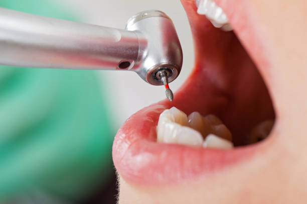 Best Cracked Tooth Emergency Dentist  in Auburn Hills, MI